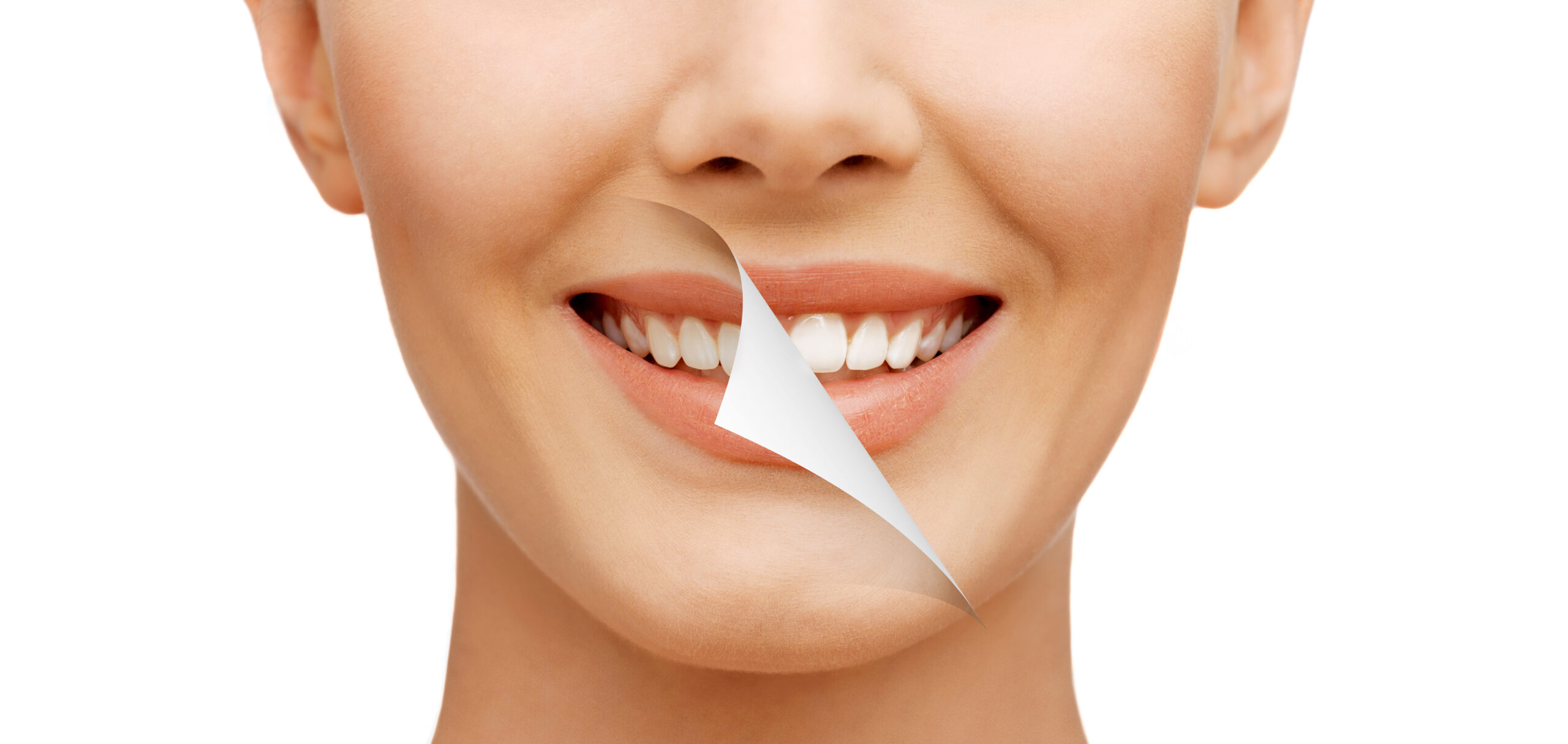 Beauty,And,Dental,Health,Concept,-,Beautiful,Woman,With,White